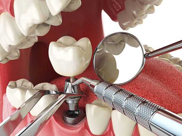 Dentist for Dental Trauma in NJ